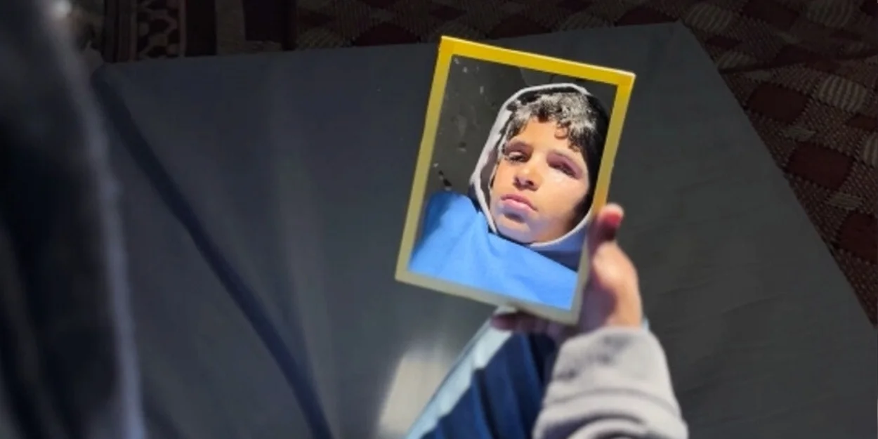 Gazze’de gözünü kaybeden çocuk protez göz bekliyor