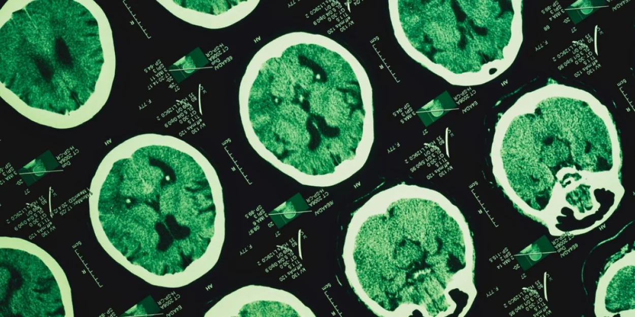 Dünya Uyku Günü’nde kritik uyarı: Beyin gece yenileniyor